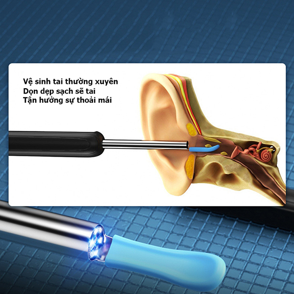 Que lấy ráy tai có camera nội soi đa năng, thông minh 